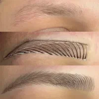 جذب کلاینت میکروبلیدینگ، فیبروز و شیدینگ با تخفیف