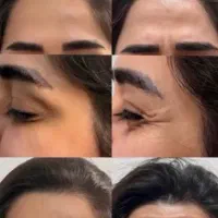 تخفیفات ویژه بوتاکس صورت و فیلر لب،فول فیس و...|خدمات آرایشگری و زیبایی|مشهد, شهید فرامرز عباسی|دیوار