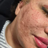 پی آر اف صورت مو دست|خدمات آرایشگری و زیبایی|اصفهان, ملک|دیوار