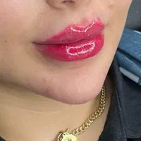 تتو ابرو میکروبلیدینگ شیدینگ ژل ومزو و وپی ارپی