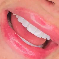 سلامت زیبای با دنتال رویال