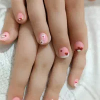 کاشت و ژلیش و لمینت با قیمت و تخفیف استثنایی