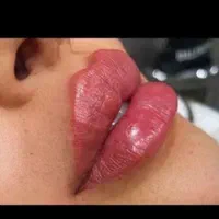 لیزر تضمینی بوتاکس فیلر مزو زگیل کرایو prp لاغری