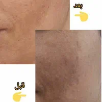 مشاوره تخصصی پوست ومو وپیشنهاد بهترین محصولات