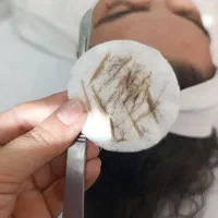 فیشال و خدمات پوستی در کلینیک|خدمات آرایشگری و زیبایی|اسلامآباد غرب, |دیوار