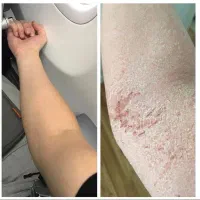 ترشی اگه بخوری