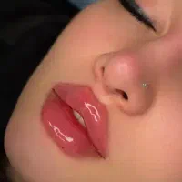 تزریق تخصصی ژل و بوتاکس و فیلر بدن و جوانساز ها