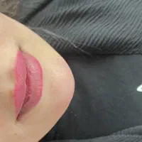 ژل و بوتاکس|خدمات آرایشگری و زیبایی|شوشتر, |دیوار