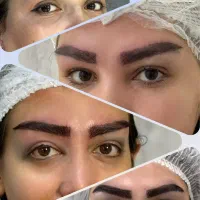 کاشت ابرو دائمی در رشت-پرداخت دومرحله ای