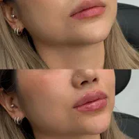 مطب پوست زیبایی لاغری