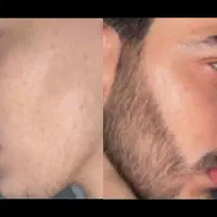 مـکمـل پـرپشتی ریــش و سـیبـیل تـضمینـی