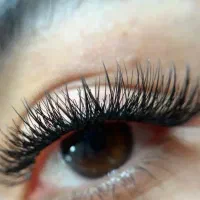 تخفیف ویژه کاشت هیدن