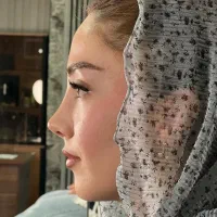 عمل بینی/در تهران/اقساط/بدون سود/ضمانت کتبی