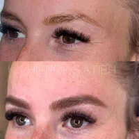 میکروبلیدینگ ابرو