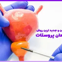 پایان مشکلات پروستات