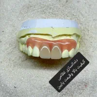 ساخت دندان مصنوعی سرامیکی دریک روز