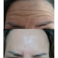 ژل لب 600|خدمات آرایشگری و زیبایی|ماهدشت, |دیوار