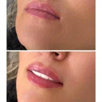 جشنواره تخفیفی و اقساطی تمام خدمات کلینیک زیبایی