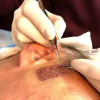 ۵۰٪تخفیف کاشتمو در شیراز|خدمات آرایشگری و زیبایی|خرم‌آباد, |دیوار