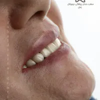 دستیار دندانپزشک شیفت شب