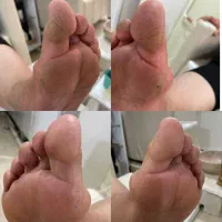 پدیکور درمانی