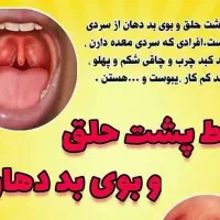 خلط پشت حلق