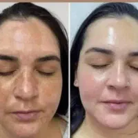 مصرف چند تا دمنوش وروغن ودوره پاکسازی ۴ ماهه
