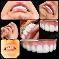 دندانپزشکی، لمینت،ایمپلنت ،دیجیتال،نقدواقساط|خدمات آرایشگری و زیبایی|مشهد, سناباد|دیوار