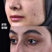 جراحی بدون نقص و متفاوت|خدمات آرایشگری و زیبایی|تهران, ازگل|دیوار