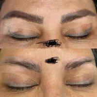 ریموو تک جلسه ای/با بهترین متریال(رژووی)