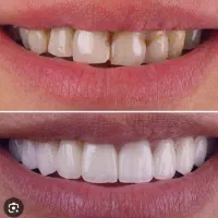 دستیار دندانپزشک اقا یا دندانساز متقاضی دستیاری