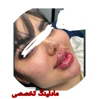 تزریق چربی. .مادلینگ .شکم .پهلو درکلینیک تخصصی|خدمات آرایشگری و زیبایی|کرمانشاه, |دیوار
