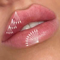 دعوت ازپزشک عمومی جهت تزریق فیلر
