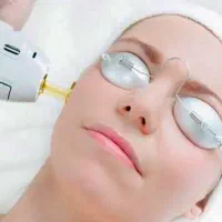 لیزر موهای زائد الکس کندلا ۲۰۲۶ اصل