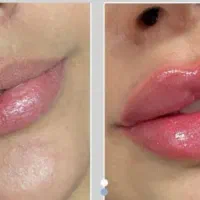 آموزش صفرتاصد فیشیال تخصصی بامدرک فنی حرفه ایی ..|خدمات آموزشی|تهران, نیروی هوایی (پیروزی)|دیوار