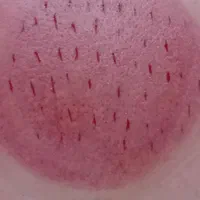 حجامت عام و خاص