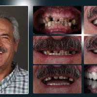 جراحی‌تخصصی‌ایمپلنت/اقساط ویژه