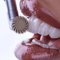 خدمات دندانپزشکی*هنر دنت*|پزشکی|سهند, |دیوار
