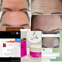 کرم بوتاکس دنا طب اصل شارژ شد