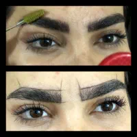 مدل میکروبلیدینگ فیبروز کاورتاتوقدیمی نانوبروز|خدمات آرایشگری و زیبایی|ری, اقدسیه|دیوار