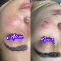 آموزش و خدمات پاکسازی پوست چالوس|خدمات آرایشگری و زیبایی|چالوس, |دیوار