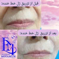 مطب پوست،مو،زیبایی دکتر الهام متمم|خدمات آرایشگری و زیبایی|رشت, گلسار|دیوار