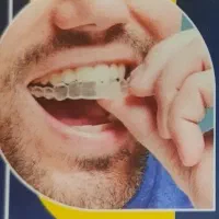 ارتودنسی شفاف الاینر|پزشکی|تهران, آسمان|دیوار