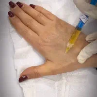 معجزه پوست و مو با پی ار پی|خدمات آرایشگری و زیبایی|خرمشهر, |دیوار