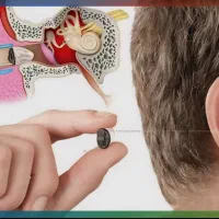 سمعک و ارزیابی شنوایی کلینیک ولیعصر|پزشکی|تهران, بلوار کشاورز|دیوار