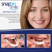 لمینت‌متحرک/دوفک/پرداخت درمنزل/روکش/ترواسمایل|آرایشی، بهداشتی، درمانی|مشهد, طلاب|دیوار