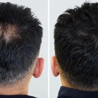 کلا پنج دقیقه تایم میخواد