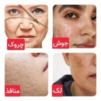 جوش وچین وچروک ولاغری وچاقی