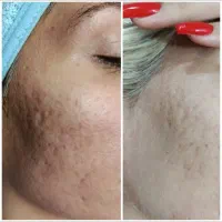 کلیه خدمات آرایشی وزیبایی
