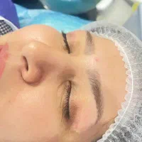 بلفارو ساکشن غبغب بوتاکس ابدو مامو|خدمات آرایشگری و زیبایی|مشهد, فردوسی|دیوار